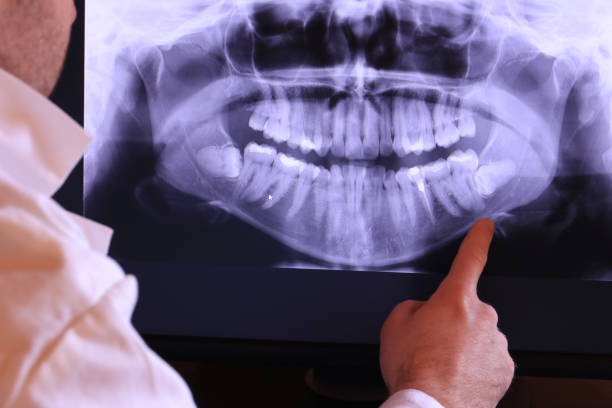 Best Emergency Tooth Extraction in Meadview, AZ